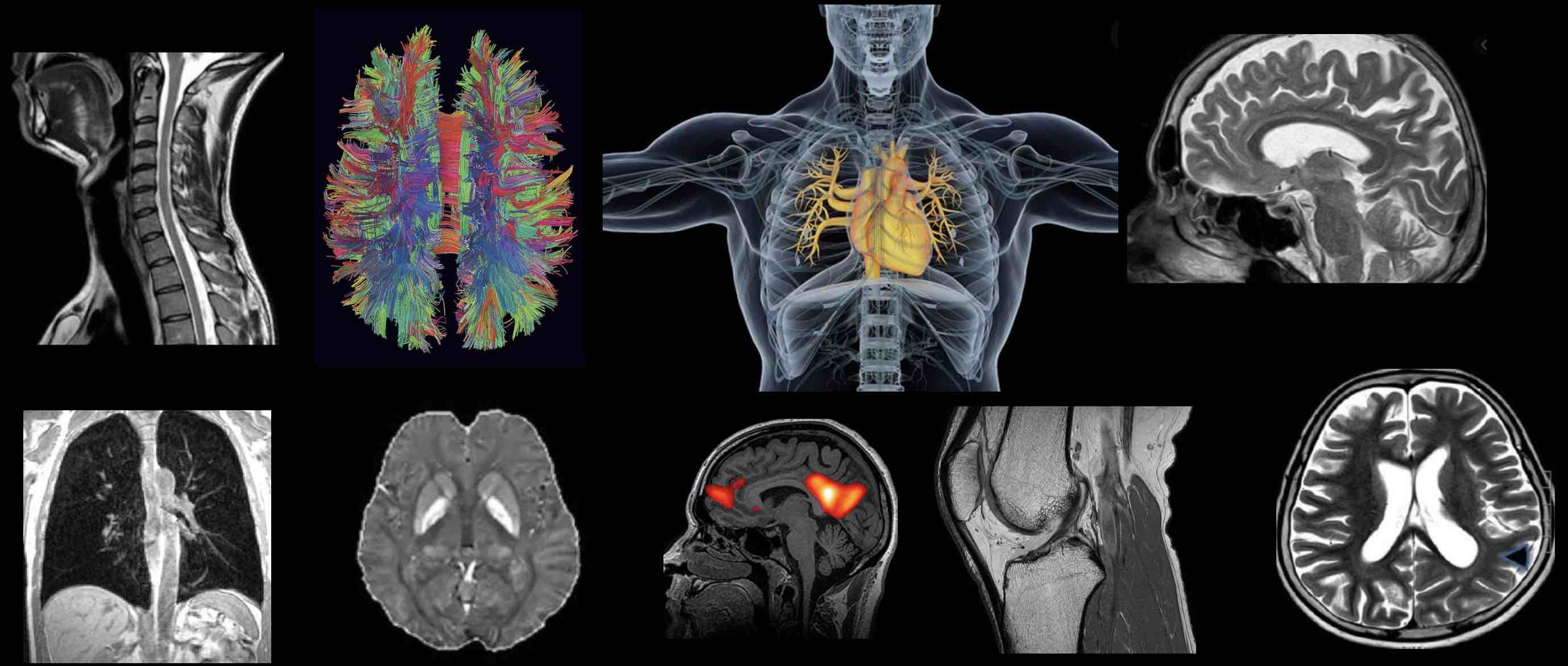 ISMRM-ANZ Community